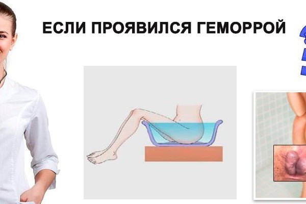 Украли аккаунт на кракене что делать